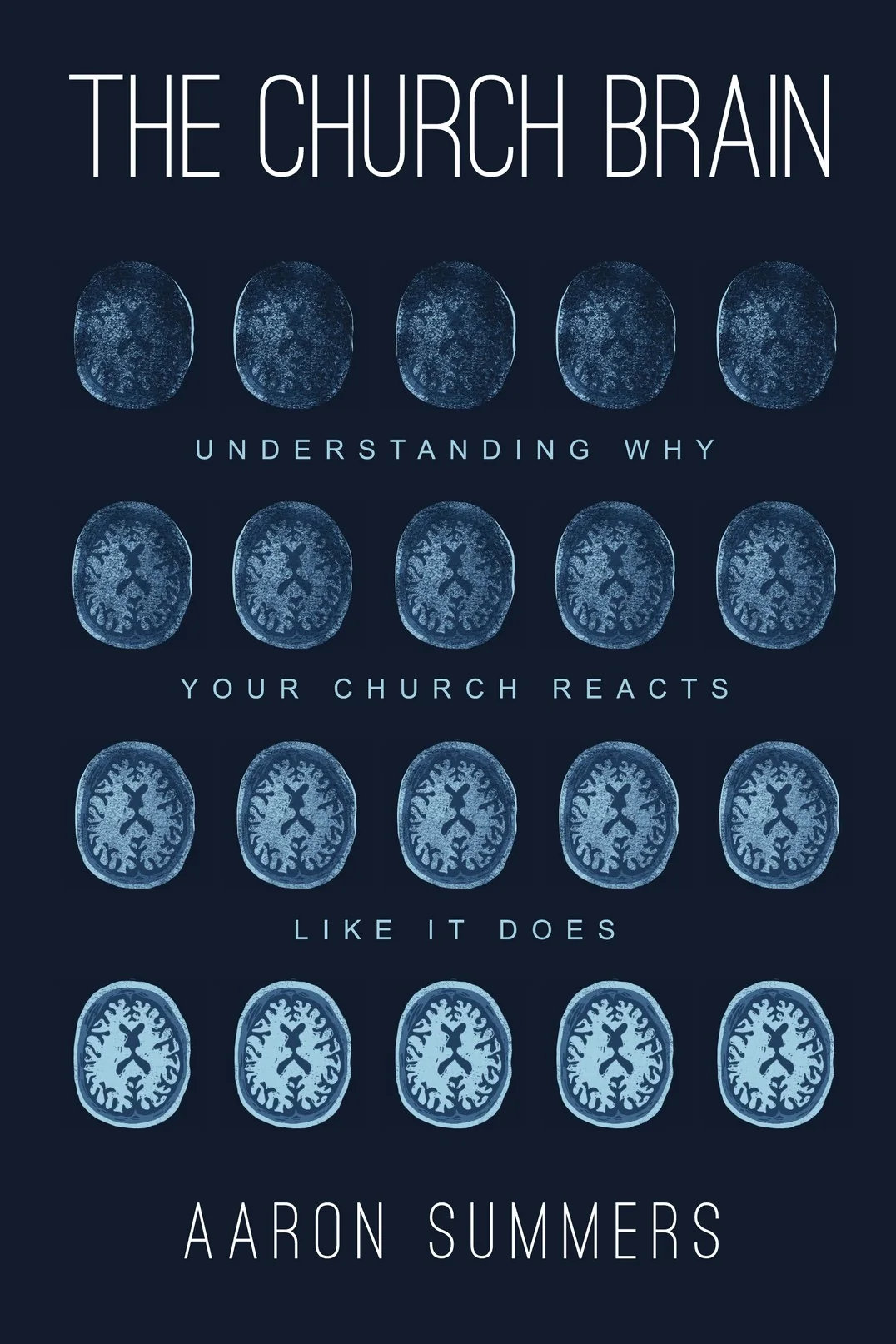 The Church Brain: Understanding Why Your Church Reacts Like It Does by Dr. Aaron Summers